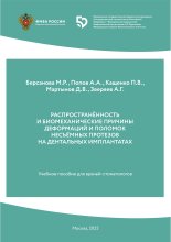 РАСПРОСТРАНЕННОСТЬ И  БИОМЕХАНИЧЕСКИЕ ПРИЧИНЫ  ДЕФОРМАЦИЙ И ПОЛОМОК   НЕСЪЁМНЫХ ПРОТЕЗОВ   НА ДЕНТАЛЬНЫХ ИМПЛАНТАТАХ