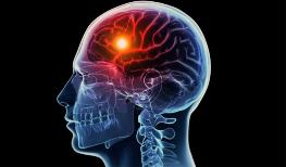 14.11.2016 стартует курс "Актуальные вопросы диагностики, лечения и профилактики инсульта" для врачей-неврологов