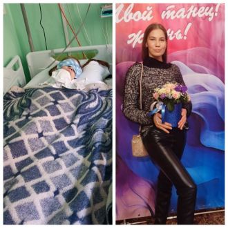 Врачи ФМБЦ им.А.И. Бурназяна ФМБА России спасли пациентку с сепсисом и септическим шоком, которые развились после тяжелой травмы в ДТП