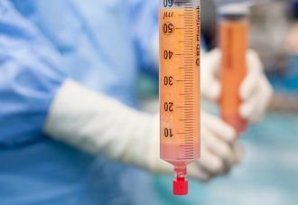 Использование стромально-васкулярной фракции жировой ткани в лечении пациентов