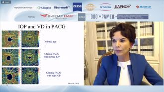 Трансляция IX Международного симпозиума «Проблемные вопросы глаукомы: фокус на первичную закрытоугольную глаукому»
