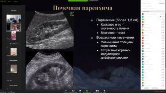 Кафедра лучевой диагностики Медико-биологического университета инноваций и непрерывного образования ФМБЦ им. А.И. Бурназяна ФМБА России продолжает обучение врачей в режиме онлайн