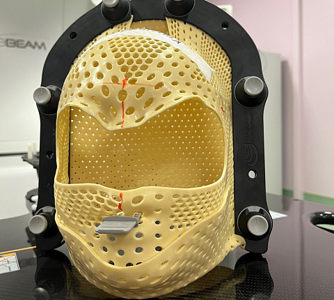 В ФМБЦ им.А.И. Бурназяна пациенты могут пройти стереотаксическое облучение