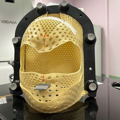 В ФМБЦ им.А.И. Бурназяна пациенты могут пройти стереотаксическое облучение