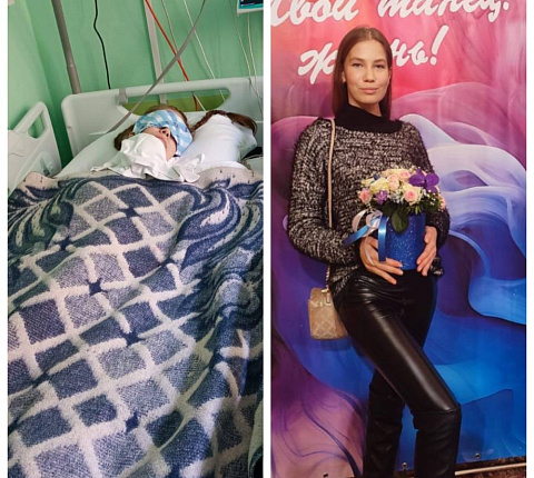 Врачи ФМБЦ им.А.И. Бурназяна ФМБА России спасли пациентку с сепсисом и септическим шоком, которые развились после тяжелой травмы в ДТП