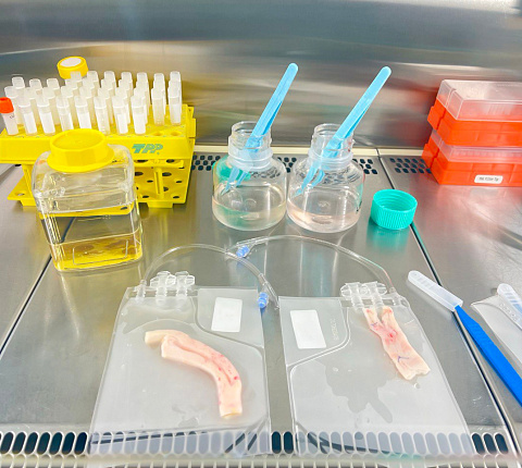 В ГНЦ ФМБЦ им.А.И.Бурназяна ФМБА России успешно функционирует криобанк донорских сосудистых аллографтов 