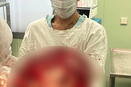 Хирурги ФМБЦ им.А.И. Бурназяна ФМБА России удалили гигантскую липосаркому