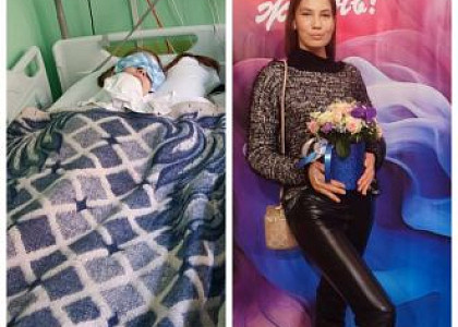 Врачи ФМБЦ им.А.И. Бурназяна ФМБА России спасли пациентку с сепсисом и септическим шоком, которые развились после тяжелой травмы в ДТП