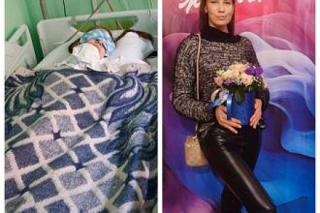 Врачи ФМБЦ им.А.И. Бурназяна ФМБА России спасли пациентку с сепсисом и септическим шоком, которые развились после тяжелой травмы в ДТП