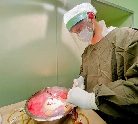 Хирурги ГНЦ ФМБЦ им. А.И.Бурназяна ФМБА России выполнили 600-ю трансплантацию печени