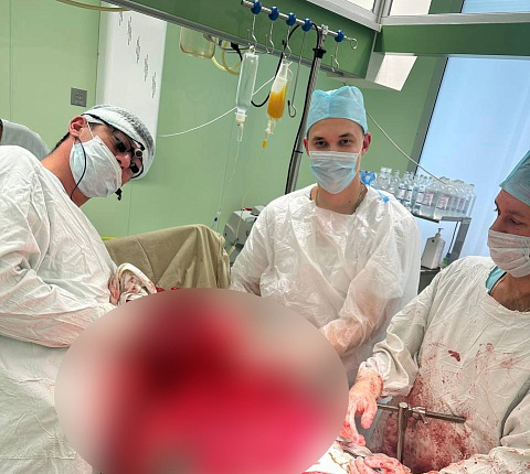 Хирурги ФМБЦ им.А.И. Бурназяна ФМБА России удалили гигантскую липосаркому