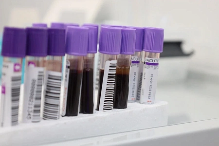 В ГНЦ ФМБЦ им.А.И. Бурназяна ФМБА России состоялась донорская акция, приуроченная к Международному  дню донора костного мозга