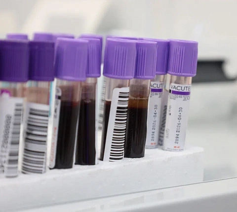 В ГНЦ ФМБЦ им.А.И. Бурназяна ФМБА России состоялась донорская акция, приуроченная к Международному  дню донора костного мозга