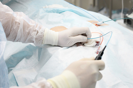 В ГНЦ ФМБЦ им.А.И.Бурназяна ФМБА России теперь доступен новый метод лечения аритмии – радиочастотная аблация (РЧА)