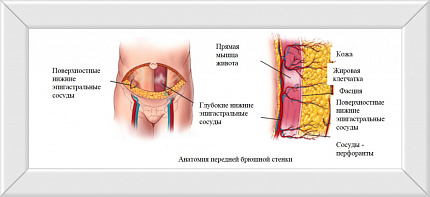 РЕКОНСТРУКТИВНАЯ ХИРУРГИЯ МОЛОЧНОЙ ЖЕЛЕЗЫ В ФМБЦ ИМ.А.И. БУРНАЗЯНА