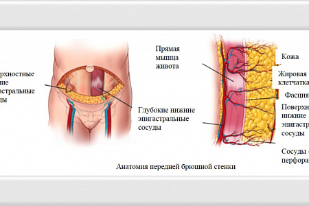 РЕКОНСТРУКТИВНАЯ ХИРУРГИЯ МОЛОЧНОЙ ЖЕЛЕЗЫ В ФМБЦ ИМ.А.И. БУРНАЗЯНА