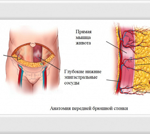 РЕКОНСТРУКТИВНАЯ ХИРУРГИЯ МОЛОЧНОЙ ЖЕЛЕЗЫ В ФМБЦ ИМ.А.И. БУРНАЗЯНА